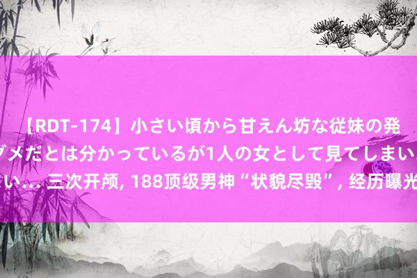 【RDT-174】小さい頃から甘えん坊な従妹の発育途中の躰が気になりダメだとは分かっているが1人の女として見てしまい… 三次开颅, 188顶级男神“状貌尽毁”, 经历曝光后网友惊叹: 太可惜